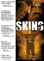 스킨스  포스터 (Skins poster)